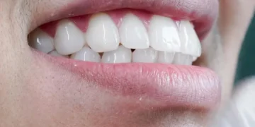 Reabilitação oral e estética dental: entenda os benefícios dos tratamentos que transformam saúde e autoestima